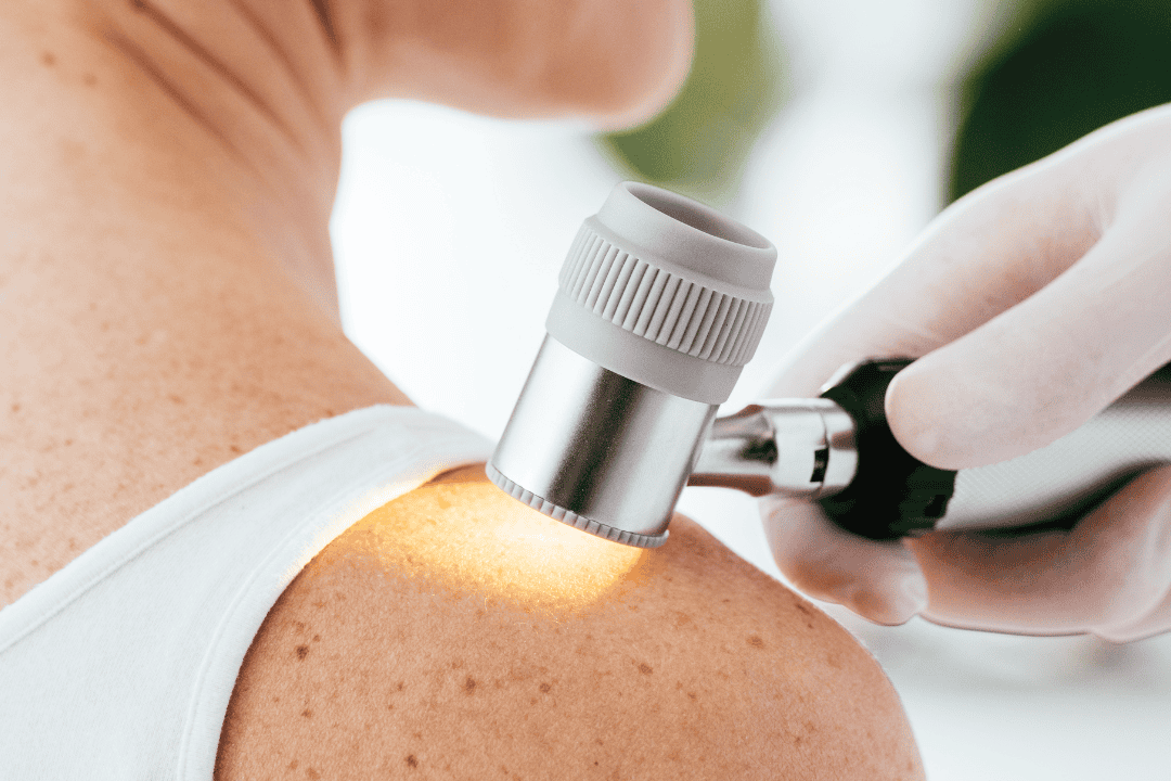 Dermatology 15 e1789765782213 - Madelia Health